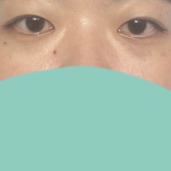 アイレノール クマクリーム/IRENOL/アイケア・アイクリームを使ったクチコミ（3枚目）