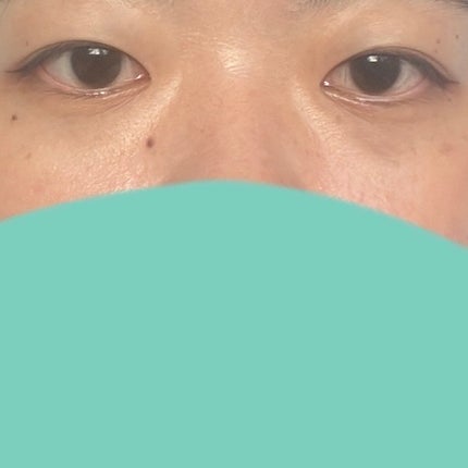 アイレノール クマクリーム/IRENOL/アイケア・アイクリームを使ったクチコミ(3枚目)