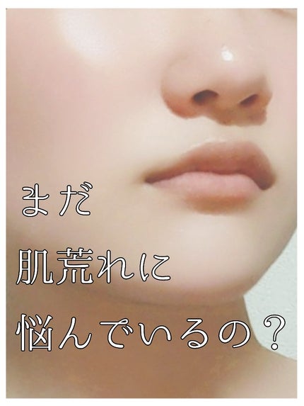 DHC マルチビタミン/DHC/美容サプリメントを使ったクチコミ(1枚目)