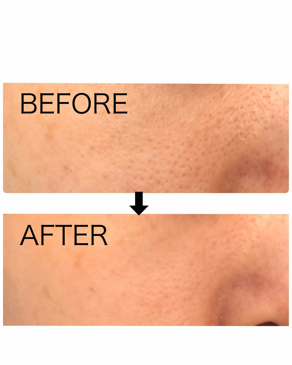 ポアレスエアリーベース/キャンメイク/化粧下地を使ったクチコミ(4枚目)