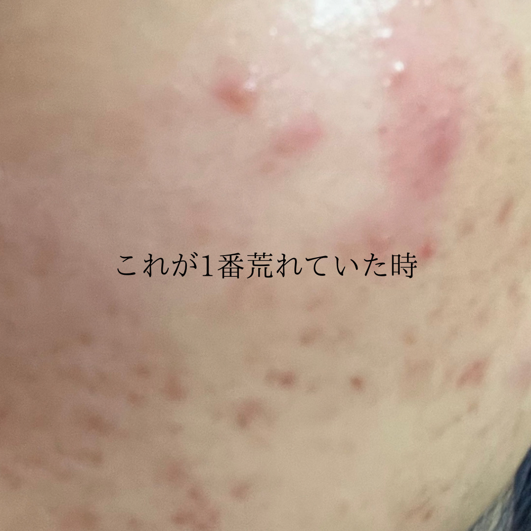 クリアフル ディープクレンジングリキッド/オルビス/クレンジングウォーターを使ったクチコミ（3枚目）