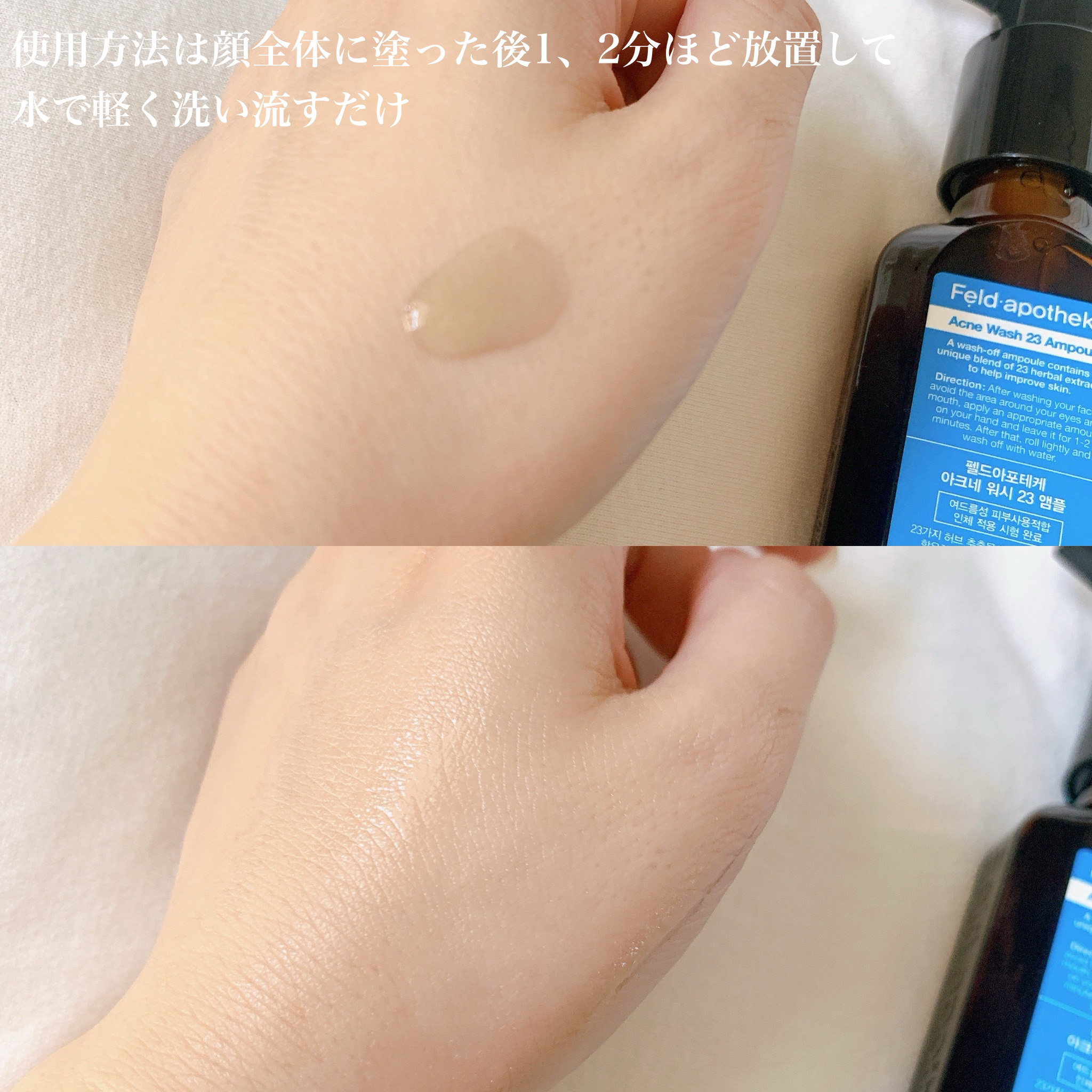 アクネウォッシュ23アンプル/Feld Apotheke/美容液を使ったクチコミ（3枚目）