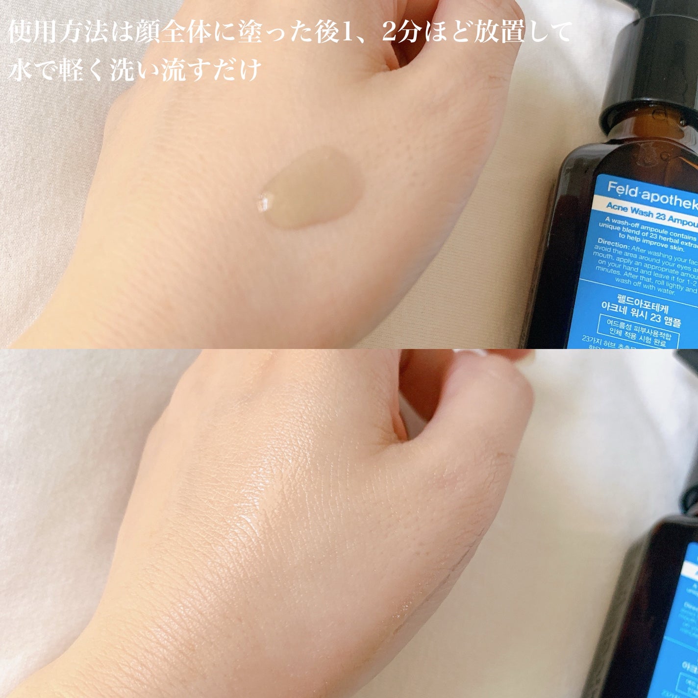 アクネウォッシュ23アンプル/Feld Apotheke/美容液を使ったクチコミ(3枚目)