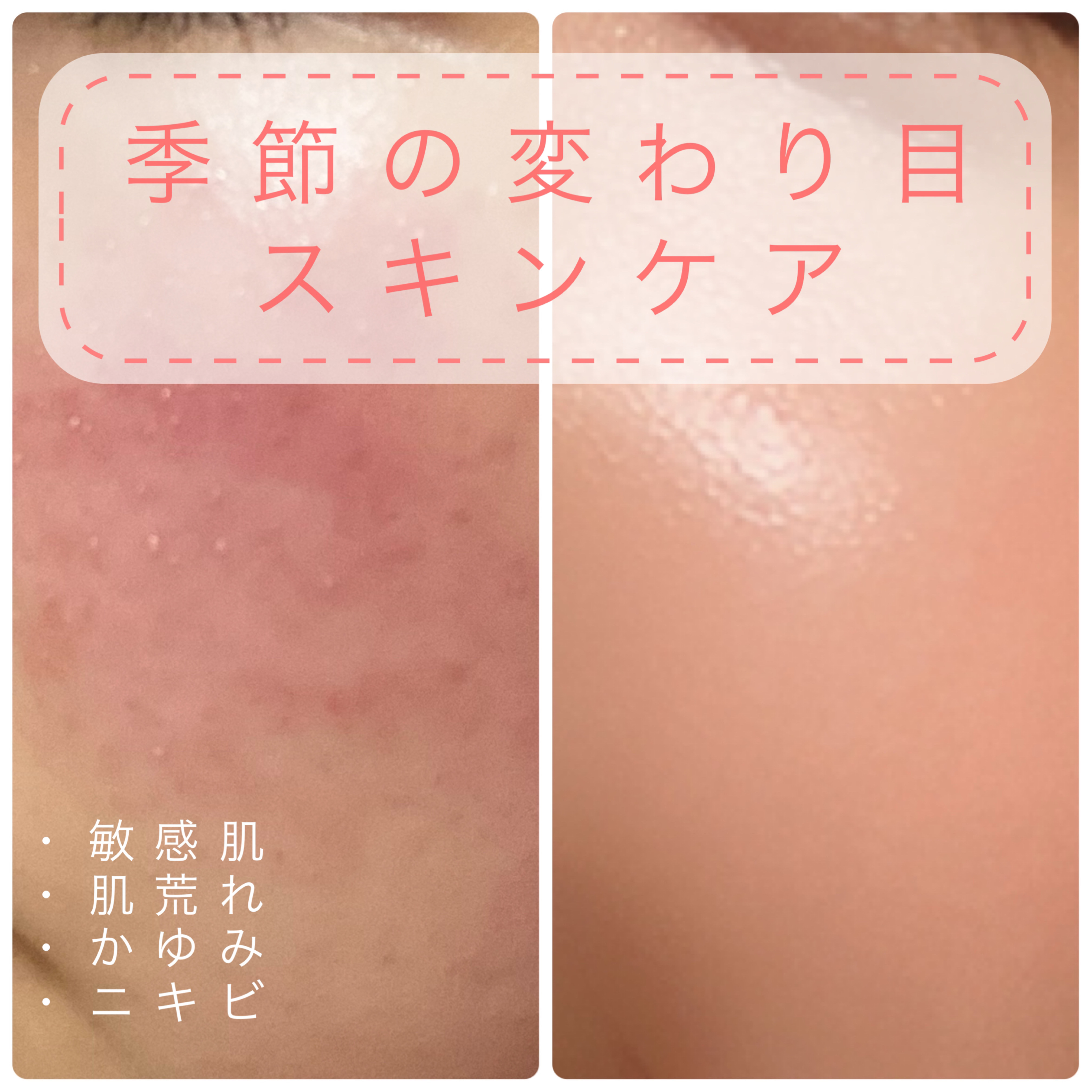 プリスクリードD(医薬品)/IHADA/その他を使ったクチコミ（1枚目）