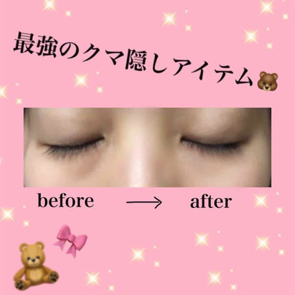 クリエイティブコンシーラーe/IPSA/パレットコンシーラーを使ったクチコミ(1枚目)