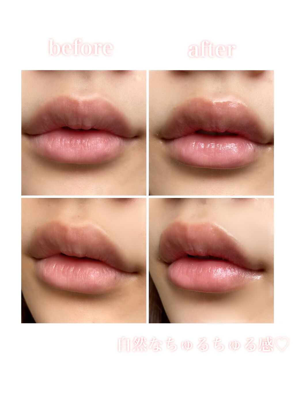 ブルーミング エディション パラダイス リップ トリートメント エッセンス ドリーム/DEAR DAHLIA/リップケアを使ったクチコミ（3枚目）