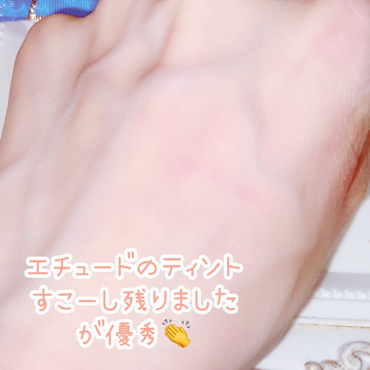 タフグルーX/フィクシー/二重まぶた用アイテムを使ったクチコミ(6枚目)