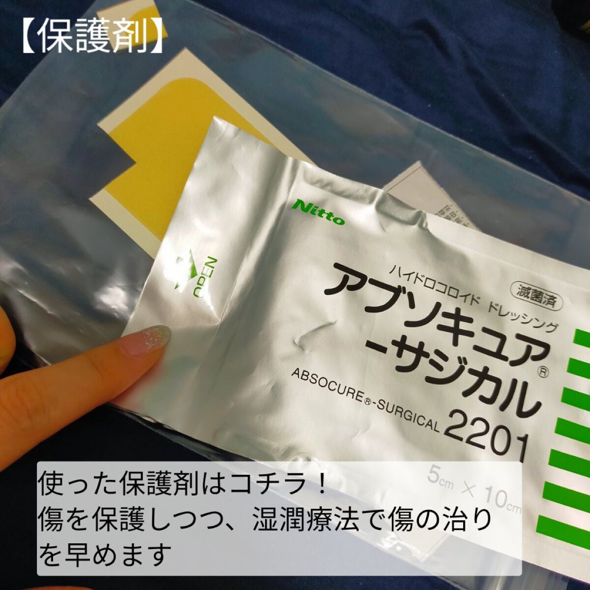 敏感肌な研究者💊あすか💊 on LIPS 「#ホクロをレーザーで除去したお話の経過報告です⚠️患部の写真が..」(3枚目)
