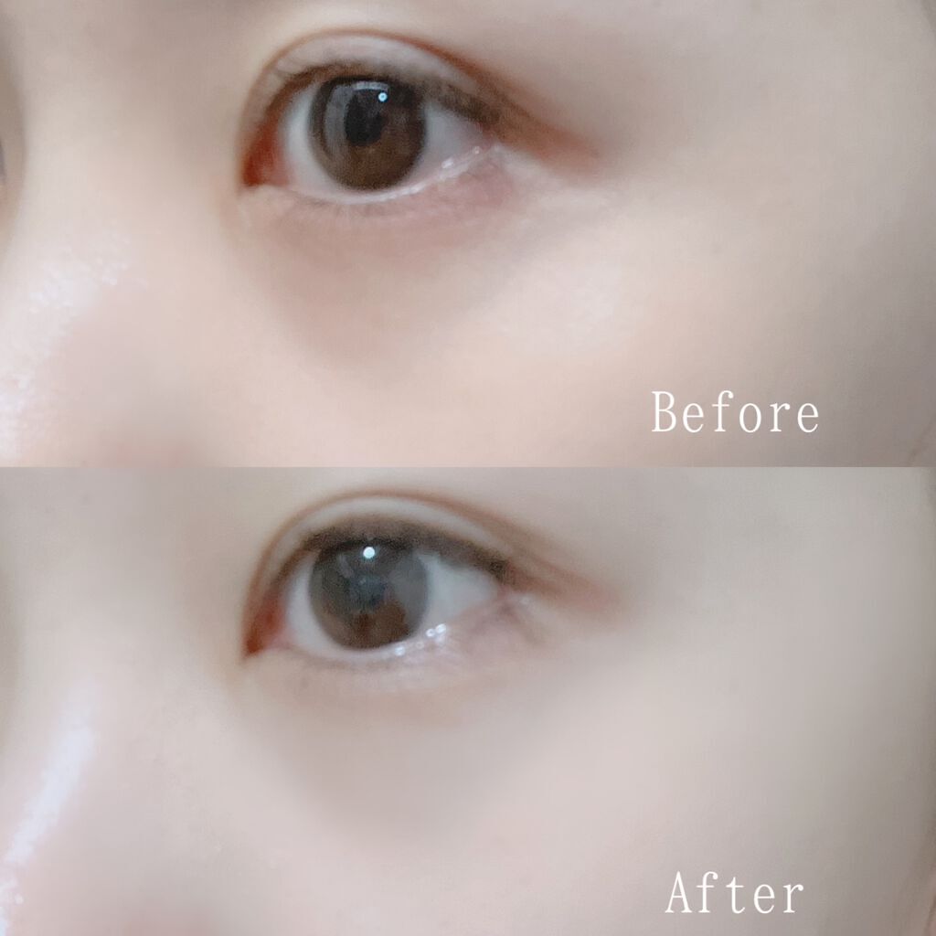 MICRO NEED ヒアルロン酸 セラムパッチ/bijoːu(ビジュー)MICRO NEED/シートマスク・パックを使ったクチコミ(5枚目)