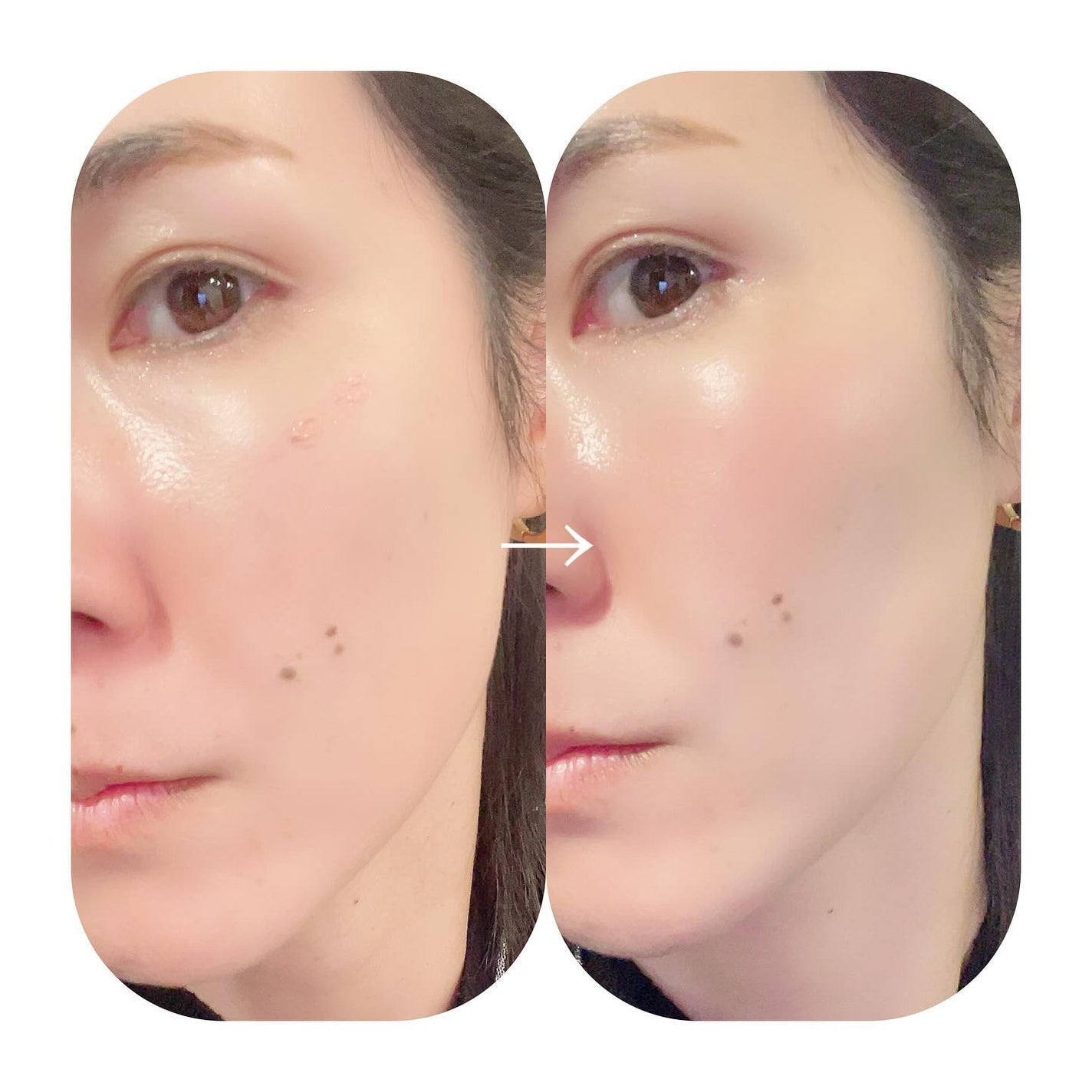 ペタルドロップリキッドブラッシャー/DEAR DAHLIA/リキッドチークを使ったクチコミ(4枚目)