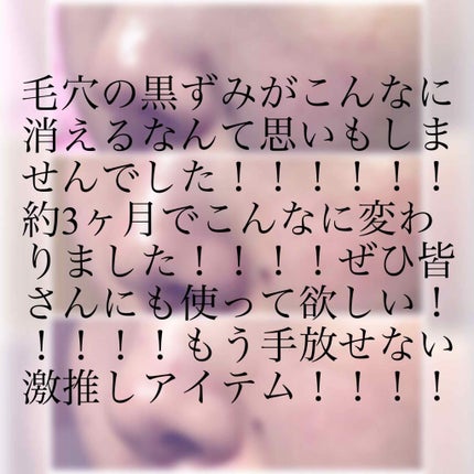 エマルジョンリムーバー 300ml/200ml/水橋保寿堂製薬/その他洗顔料を使ったクチコミ(1枚目)