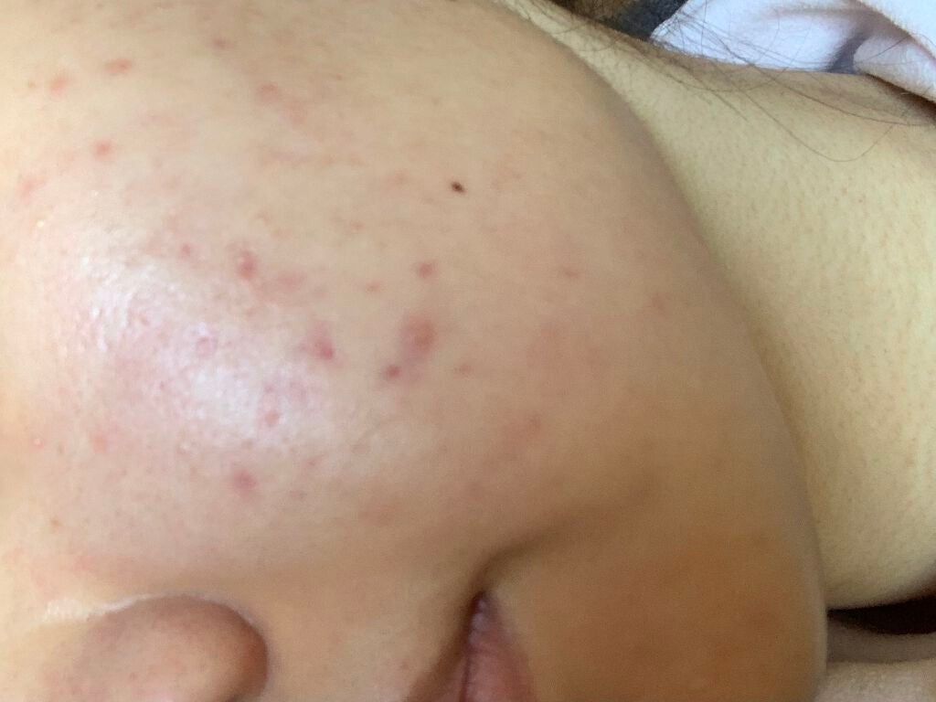 space on LIPS 「まあまあマシになってきてるかな🥺やっぱり夜が痛みます🥺で!も!..」(1枚目)