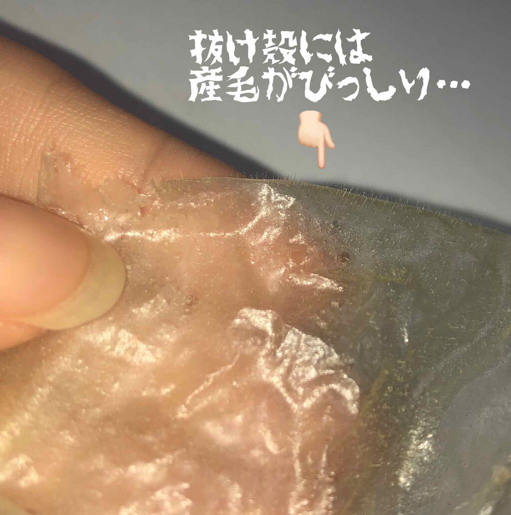 がばいよか剥がすパック アスティ コスメフリークの口コミ 敏感肌におすすめのシートマスク パック 皆さん 顔の毛って気になったことありませんか By まかろん 混合肌 代前半 Lips がばいよか剥がすパック アスティ コスメフリークの口コミ 敏感肌におすすめのシートマスク パック 皆さん 顔の毛って気になったことありませんか By まかろん 混合肌 代前半 Lips