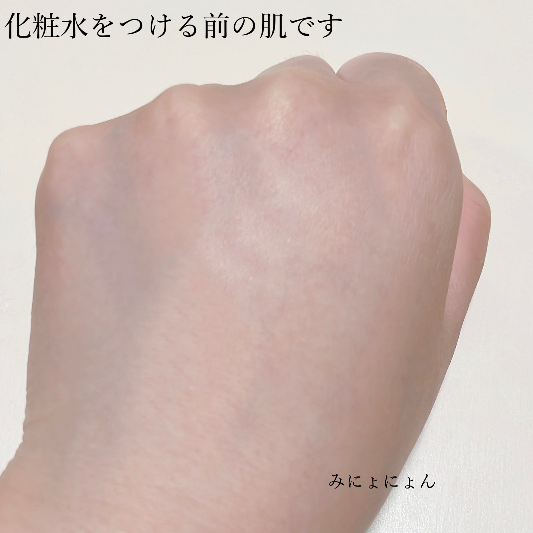 イドラクラリティ　薬用 トリートメント エッセンス ウォーター/DECORTÉ/化粧水を使ったクチコミ（3枚目）