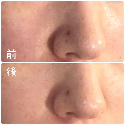 毛穴クエスト ポアクリアショットジェル AZ /エリザベス/その他洗顔料を使ったクチコミ(6枚目)