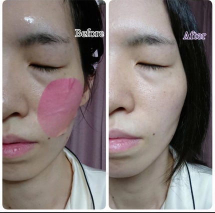 ポイントマスクシート/DAISO/シートマスク・パックを使ったクチコミ(5枚目)