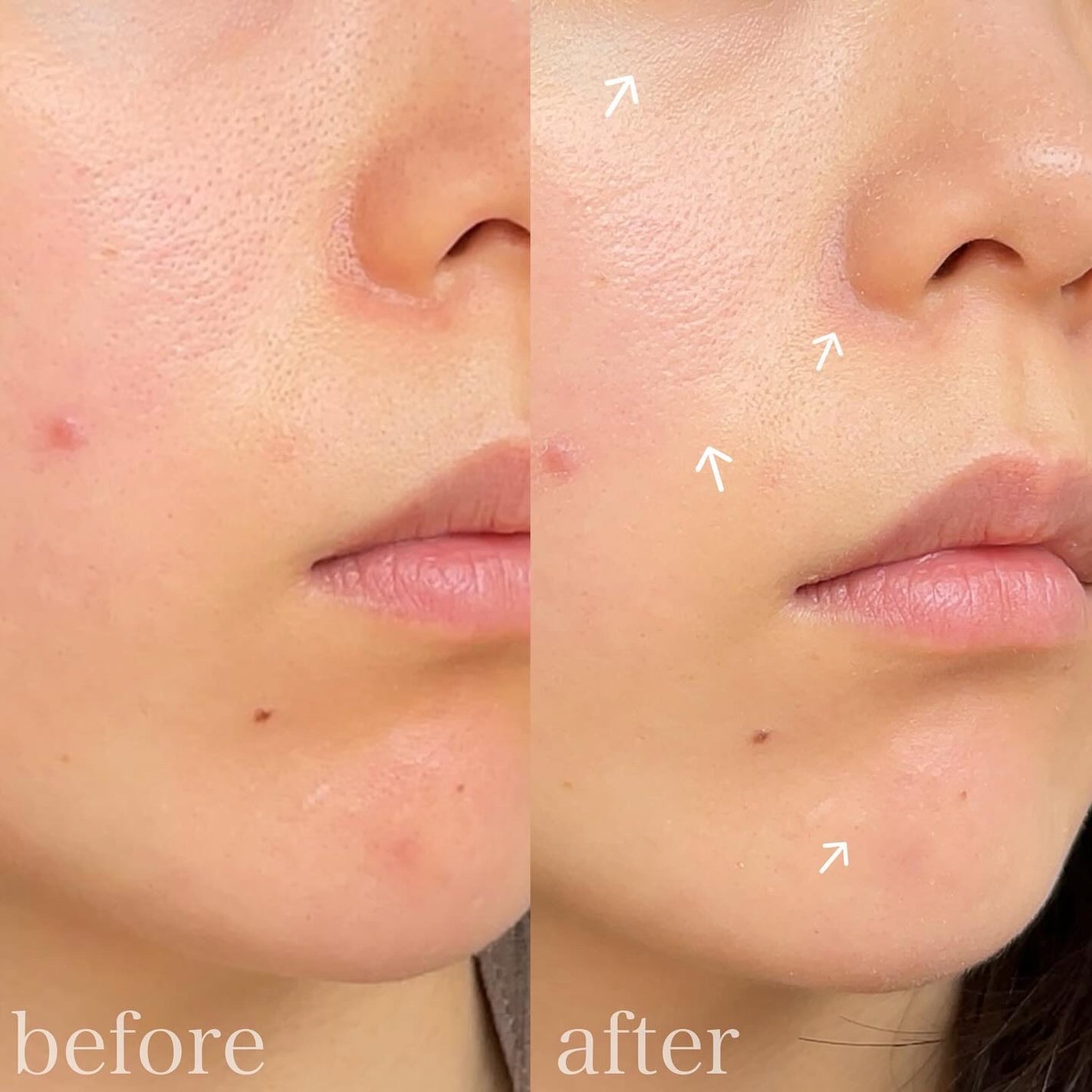 ヴェールヌーディ エッセンスパクトグロウ/AGE20’s/クリーム・エマルジョンファンデーションを使ったクチコミ(3枚目)