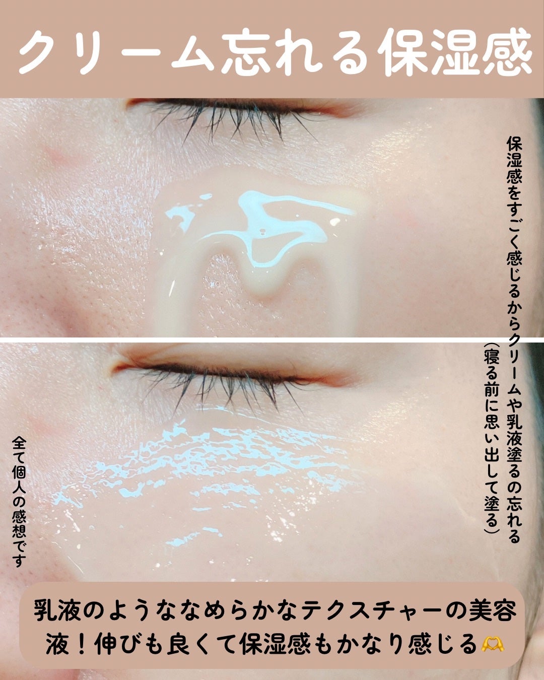 ブラックスネイルレチノールセラム/Dr.G/美容液を使ったクチコミ(4枚目)