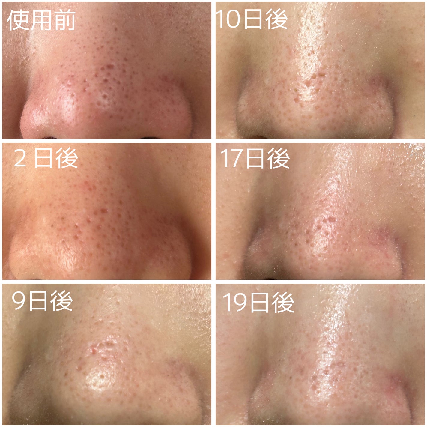 イチジク毛穴アンプル/Veganifect/美容液を使ったクチコミ(3枚目)