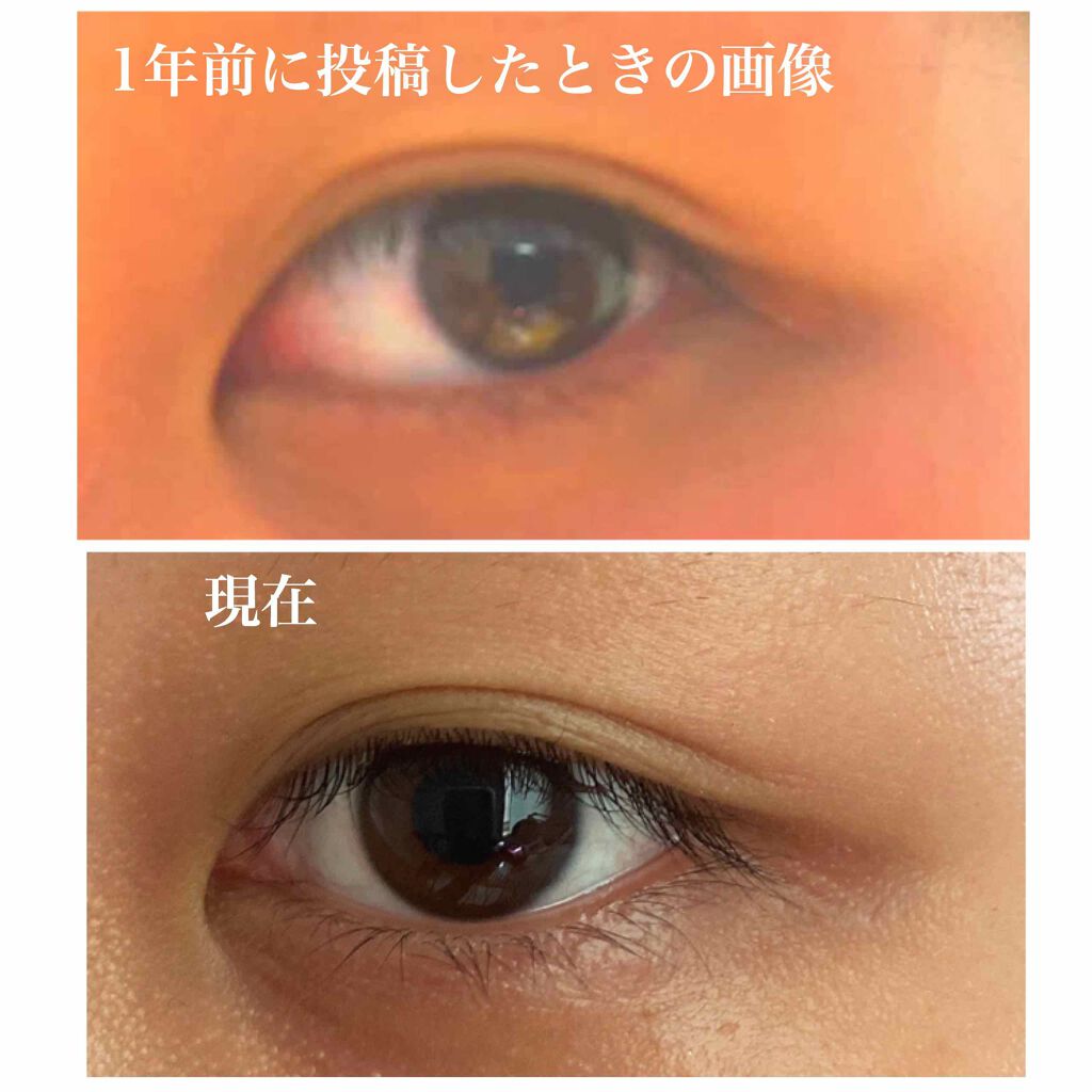 のびーるアイテープ(絆創膏タイプ、レギュラー)/DAISO/二重まぶた用アイテムを使ったクチコミ(3枚目)