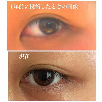 のびーるアイテープ(絆創膏タイプ、レギュラー)/DAISO/二重まぶた用アイテムを使ったクチコミ(3枚目)