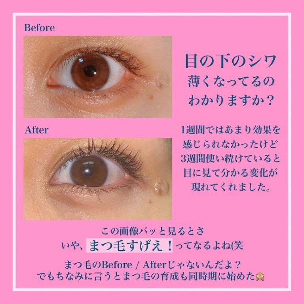 目元ふっくらクリーム NC/なめらか本舗/アイケア・アイクリームを使ったクチコミ(8枚目)