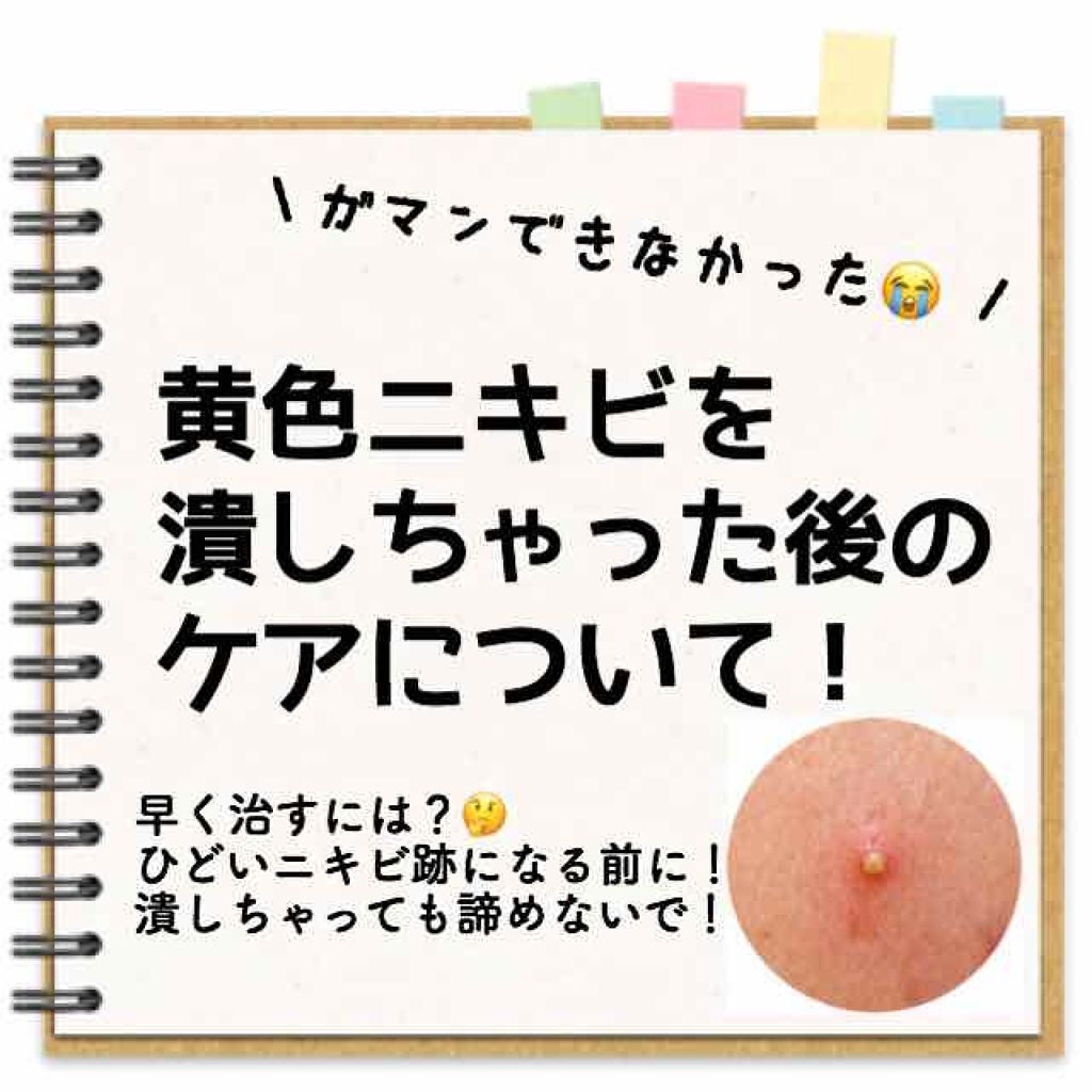ドルマイシン軟膏 医薬品 ゼリア新薬工業の口コミ どーも ニキビを潰すことが我慢できないゆり By ゆりこ 混合肌 代前半 Lips