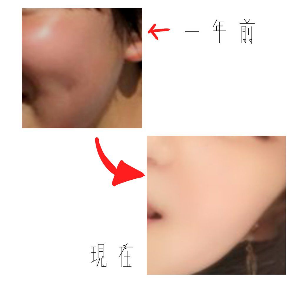 スキンアクア スーパーモイスチャージェル/スキンアクア/日焼け止めジェルを使ったクチコミ（2枚目）