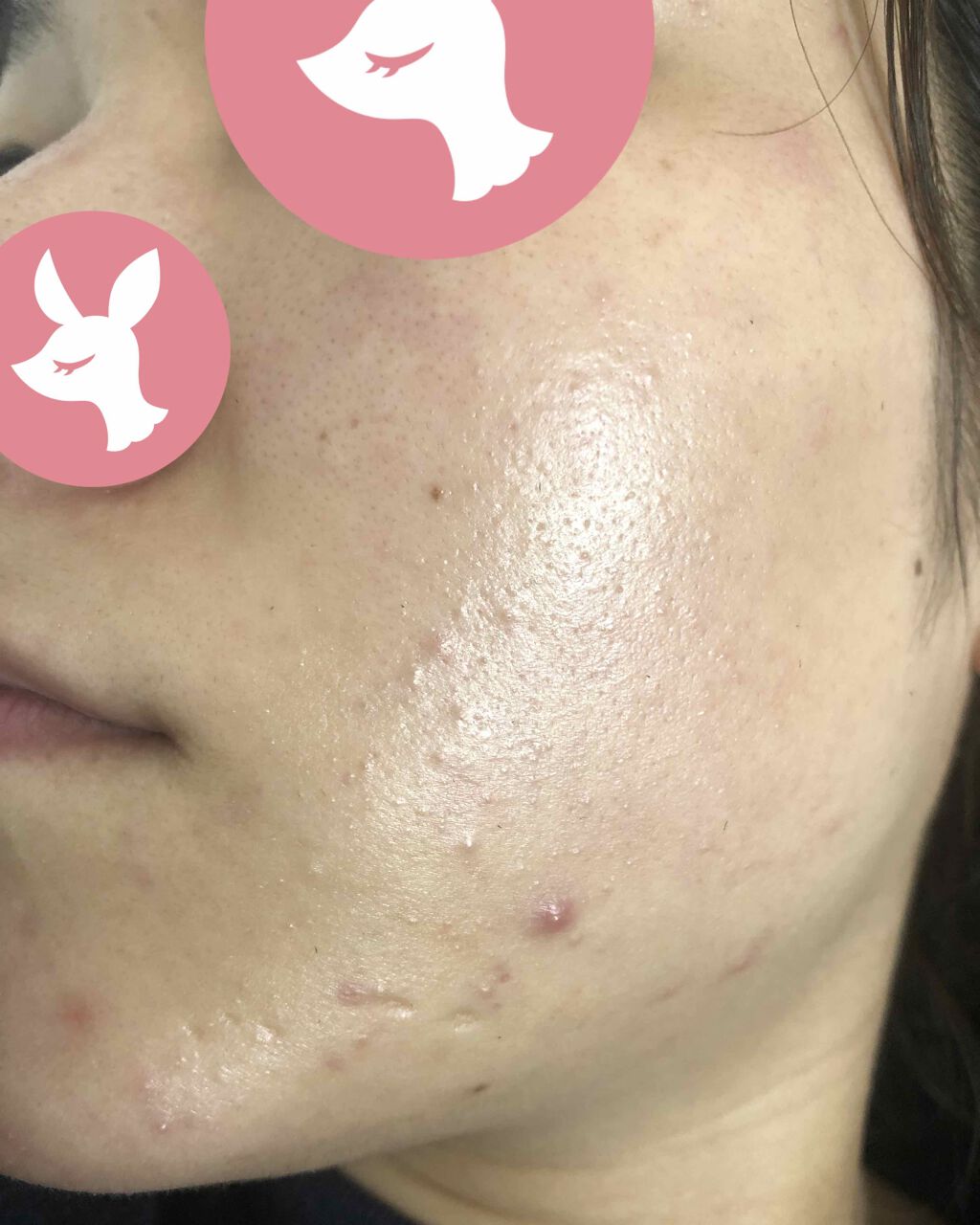 ビジャ ローション/innisfree/乳液を使ったクチコミ（3枚目）