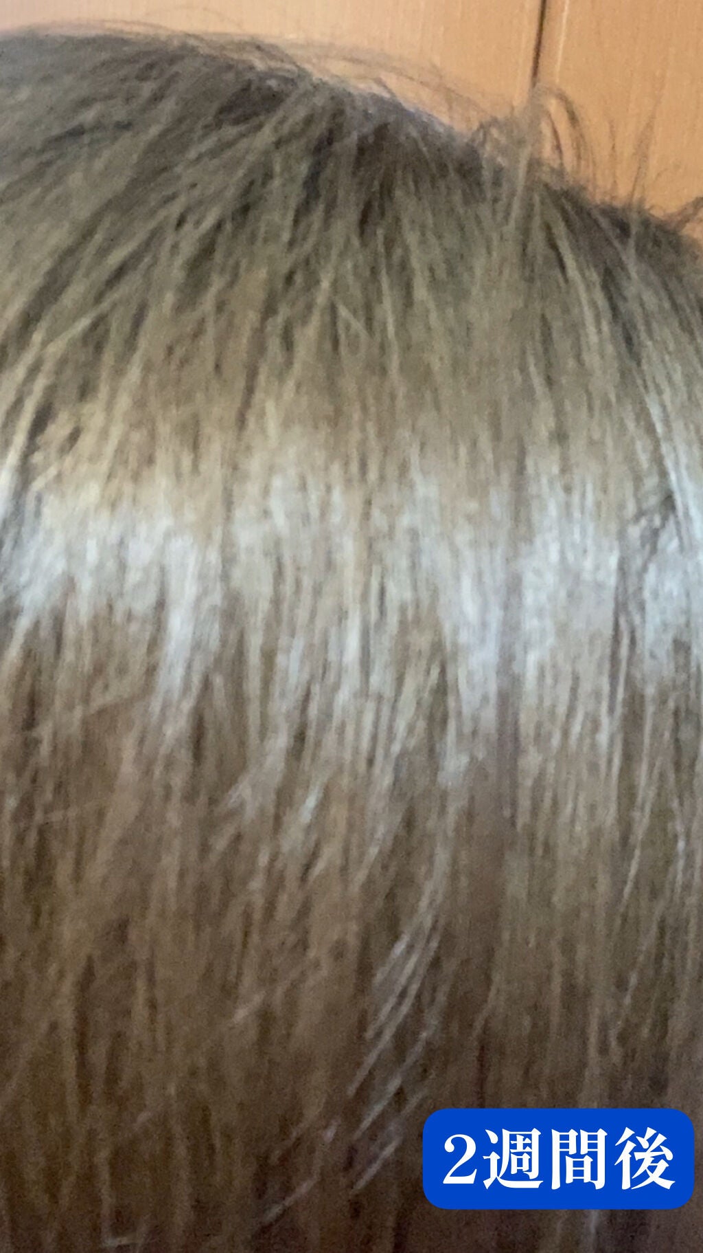 泡カラー/リーゼ/ヘアカラーを使ったクチコミ(7枚目)