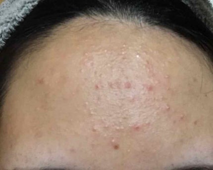 エファクラ モイスチャー バランス ローション/ラ ロッシュ ポゼ/化粧水を使ったクチコミ(3枚目)