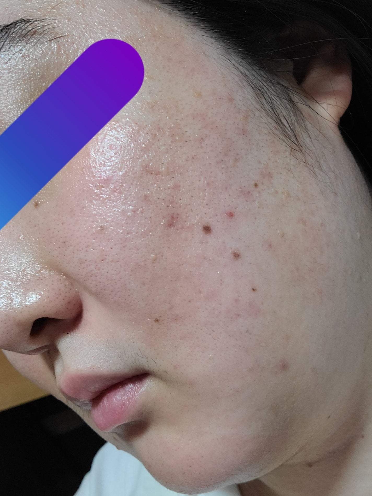 ハイドロクリーム SHQ-10/KISO/フェイスクリームを使ったクチコミ(5枚目)