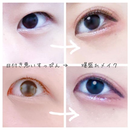 アイビューティー フィクサー WP/アストレア ヴィルゴ/二重まぶた用アイテムを使ったクチコミ(1枚目)