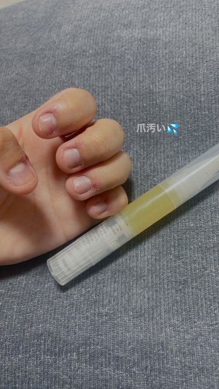 甘皮ケアオイル/無印良品/ネイルオイル・トリートメントを使ったクチコミ(1枚目)