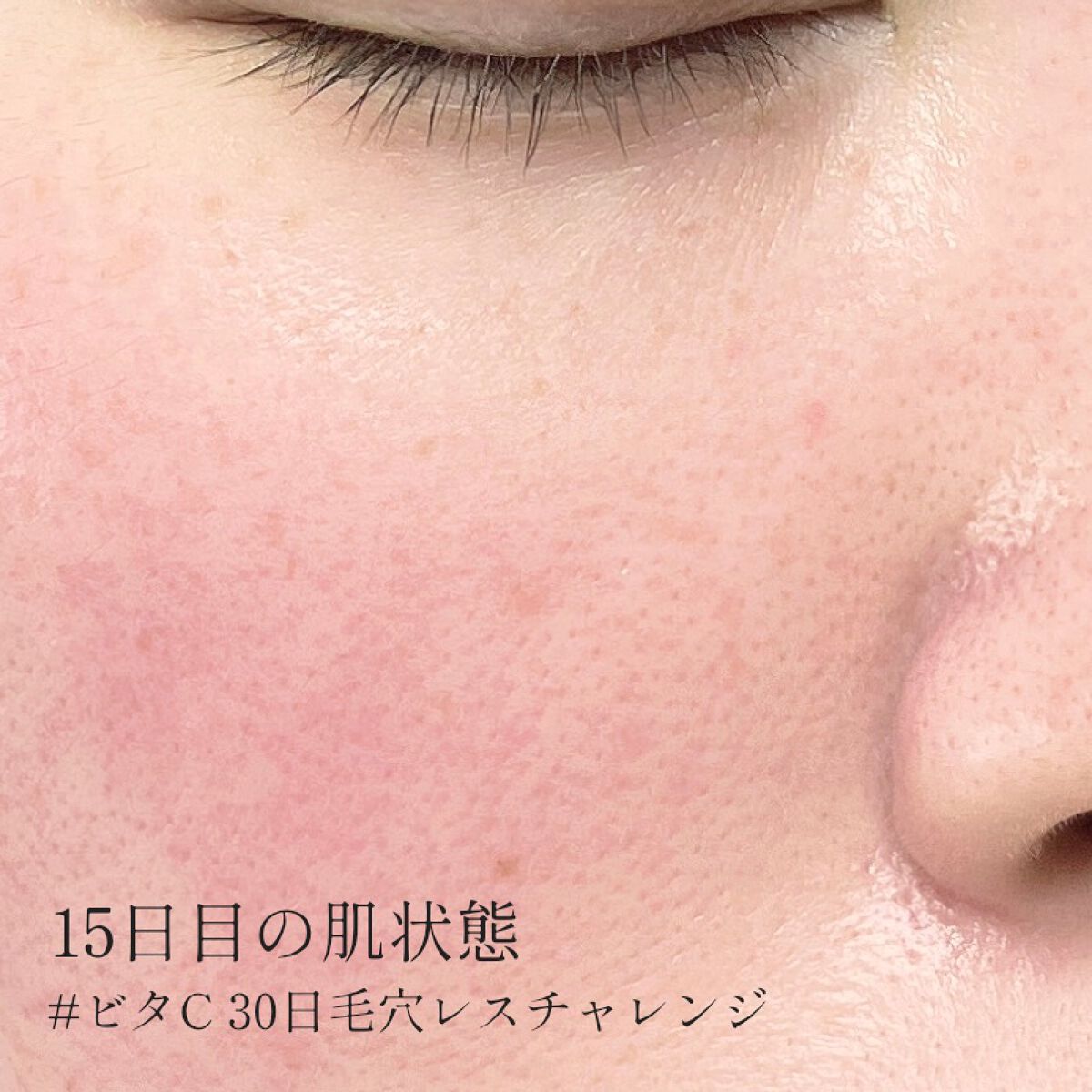 とことこ on LIPS 「#ビタC30日毛穴レスチャレンジ15日目になりました〜!!毎日..」(2枚目)