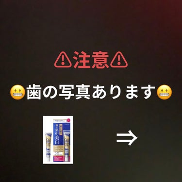 オーラツー プレミアム クレンジングペースト  プレミアムミント/オーラツー/歯磨き粉を使ったクチコミ（1枚目）