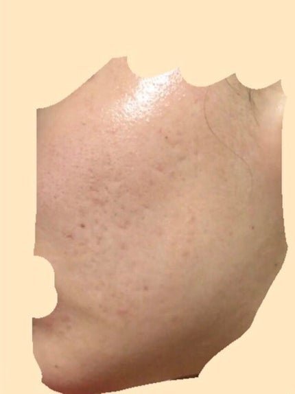 ハトムギ化粧水(ナチュリエ スキンコンディショナー R )/ナチュリエ/化粧水を使ったクチコミ(5枚目)