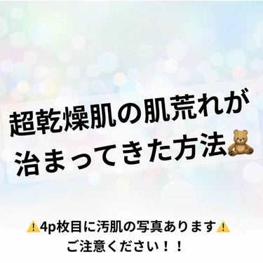 ハトムギ化粧水(ナチュリエ スキンコンディショナー R )/ナチュリエ/化粧水を使ったクチコミ（1枚目）