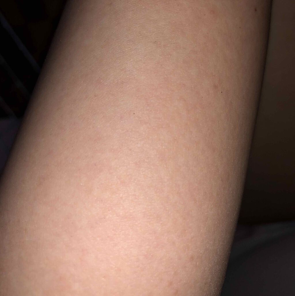 Richesse9 IPL光脱毛器/Richesse9(リシェスナイン)/家庭用脱毛器を使ったクチコミ(2枚目)