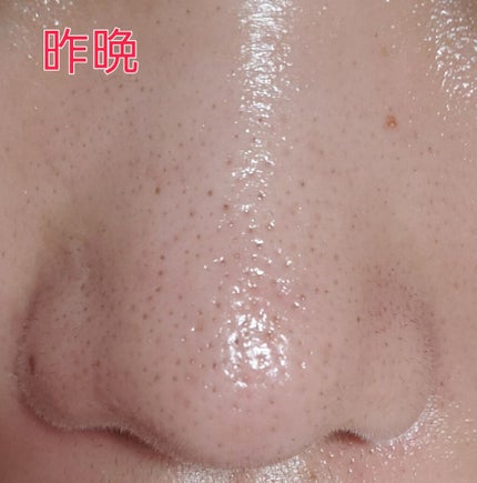 おうちdeエステ 肌をなめらかにする マッサージ洗顔ジェル/ビオレ/その他洗顔料を使ったクチコミ(2枚目)