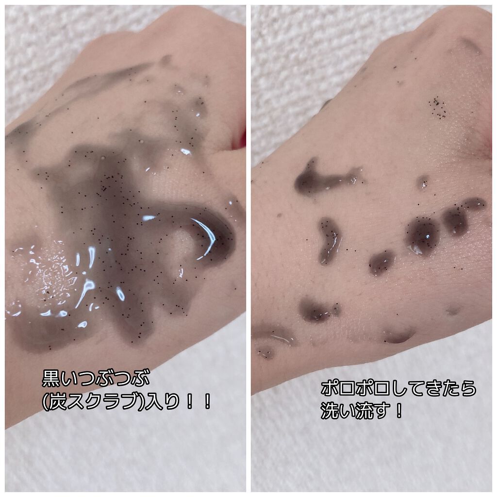 DETクリア ブライト＆ピール ピーリングジェリー＜炭タイプ＞/Detclear/ピーリングを使ったクチコミ（2枚目）