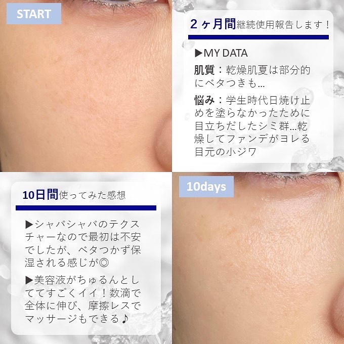 プラチナVCローション/イデアアクト/化粧水を使ったクチコミ（2枚目）