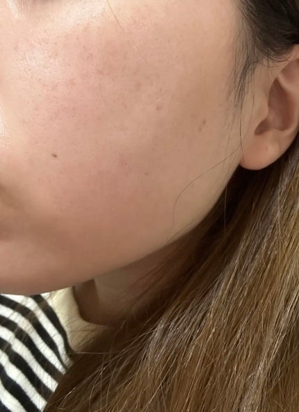 ホワイトニング ミスト セラム/アルージェ/ミスト状化粧水を使ったクチコミ(3枚目)