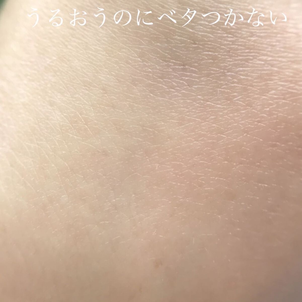 イハダ 薬用バーム【医薬部外品】 20g シトラスハーブの香り(限定)/IHADA/フェイスバームを使ったクチコミ（3枚目）