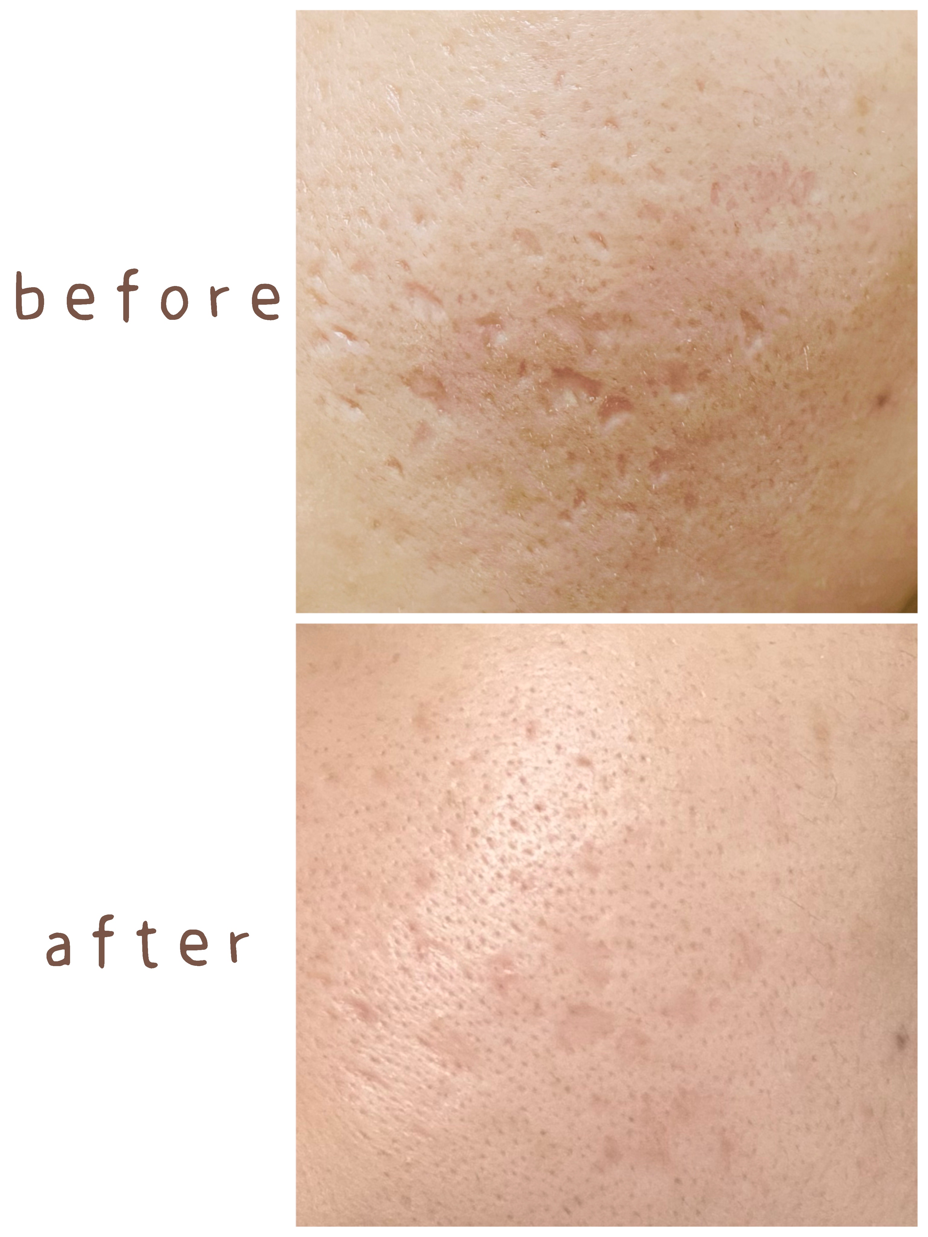 を使ったクチコミ（3枚目）