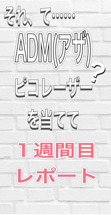 りりぃ🍊 on LIPS 「ADMの説明をわかりやすく簡単に皮膚科の先生の説明と治療につい..」（1枚目）