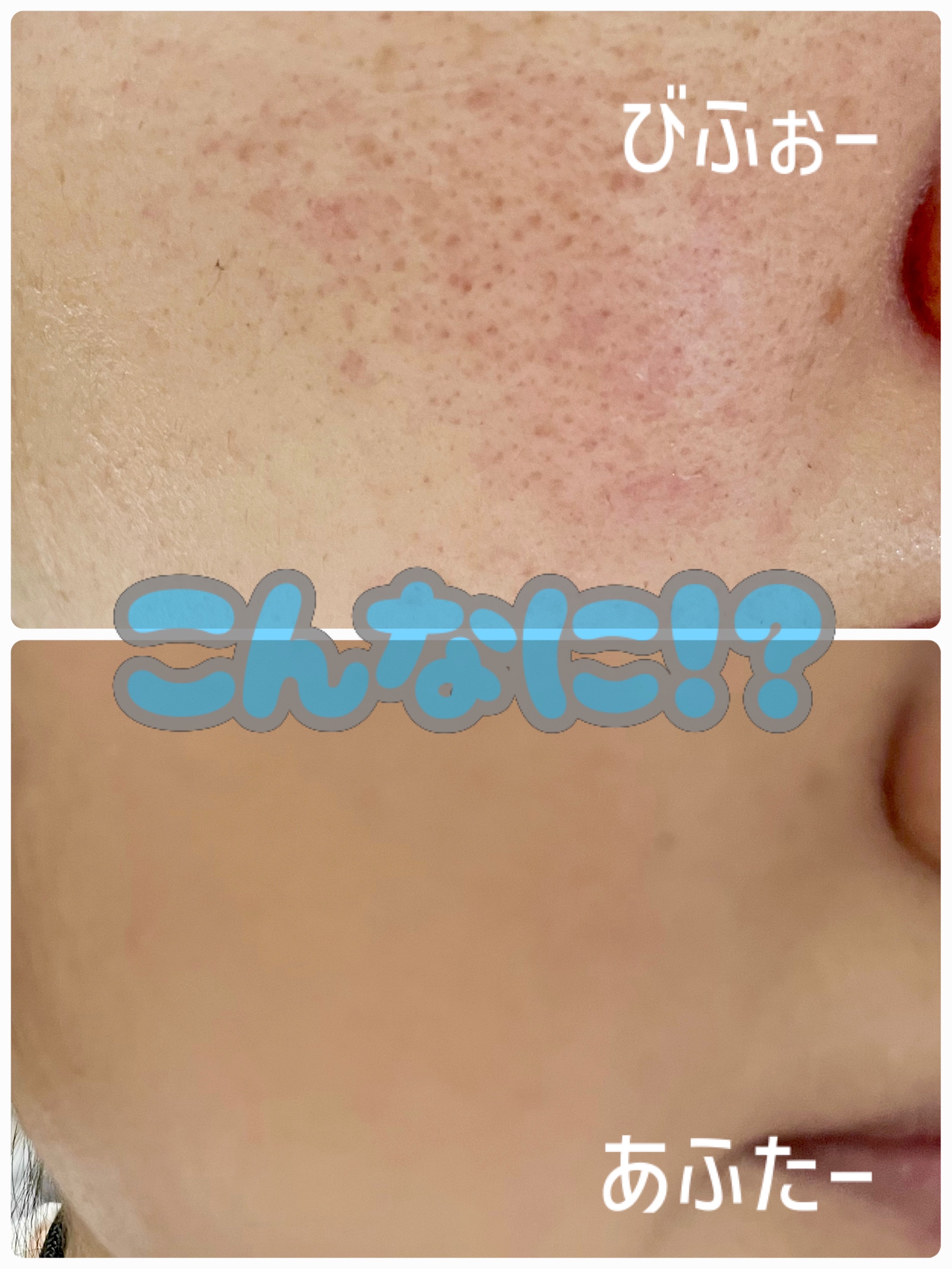 ハートリーフシーンカバークッション/23years old/クッションファンデーションを使ったクチコミ（1枚目）