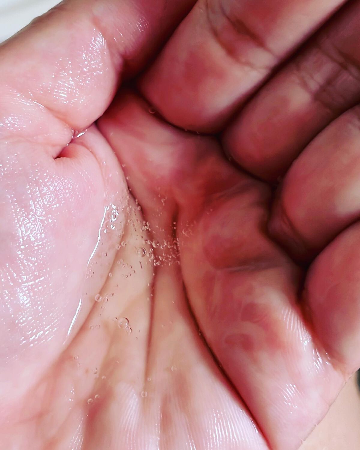 スカルプD ボーテ 薬用スカルプシャンプー (ボリューム)/薬用トリートメントパック (ボリューム)/アンファー(スカルプD)/市販シャンプーを使ったクチコミ(2枚目)