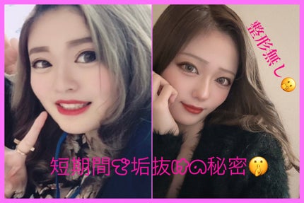 ミルクブライトニングトナー/MEDIHEAL/化粧水を使ったクチコミ(1枚目)