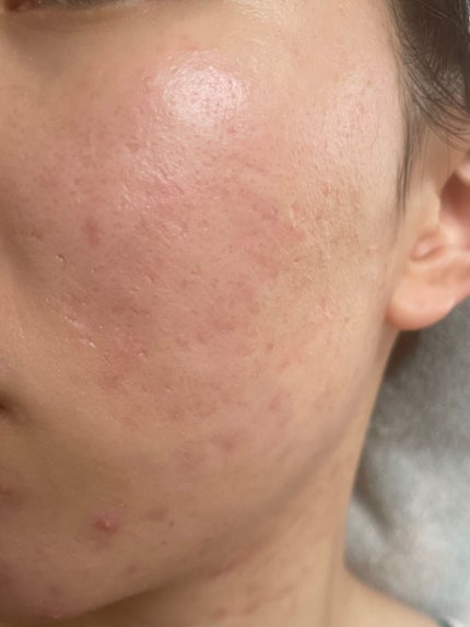 ボタニック サイエンス 薬用 美容液クッションコンパクト/HAKU/クッションファンデーションを使ったクチコミ(2枚目)